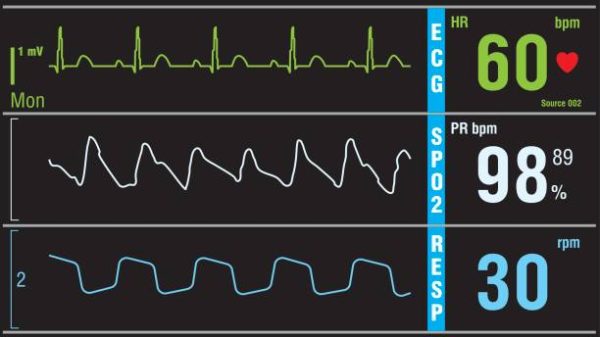 EKG Practice Test: Comprehensive Learning Modules